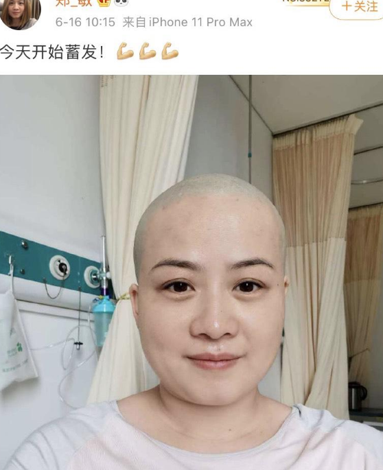 岳云鹏妻子术后复查，发文感慨要每天都活得尽兴，曾为治病剃光头